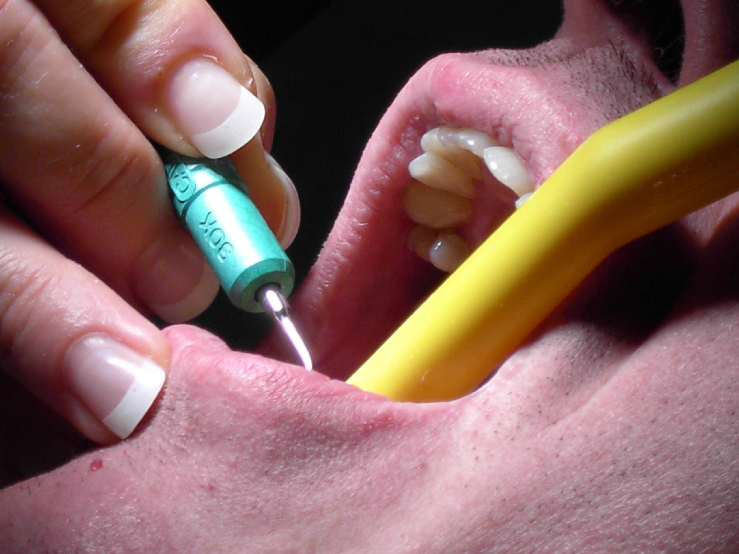 Zahnprothese im Ausland
